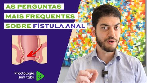 fistula anal-4
